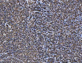 TIP49A/RUVBL1 Rabbit Polyclonal Antibody