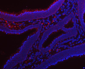 RRS1 Rabbit Polyclonal Antibody