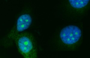 RRS1 Rabbit Polyclonal Antibody