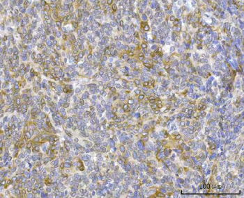 RRS1 Rabbit Polyclonal Antibody