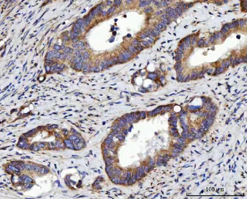 RRS1 Rabbit Polyclonal Antibody