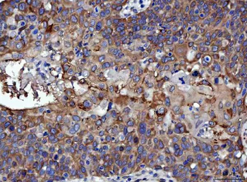 RRS1 Rabbit Polyclonal Antibody