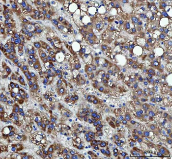 RRS1 Rabbit Polyclonal Antibody