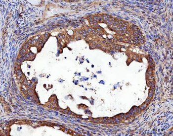 RRS1 Rabbit Polyclonal Antibody