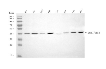 RRS1 Rabbit Polyclonal Antibody
