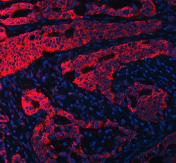 RPL36 Rabbit Polyclonal Antibody