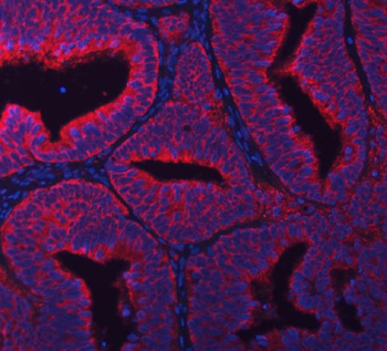 RPL36 Rabbit Polyclonal Antibody
