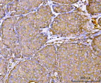 RPL36 Rabbit Polyclonal Antibody