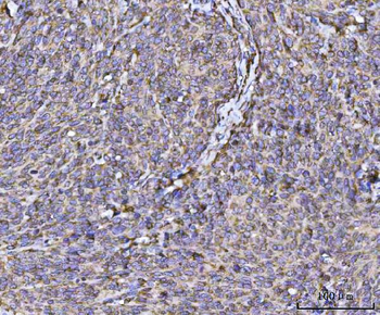 RPL36 Rabbit Polyclonal Antibody