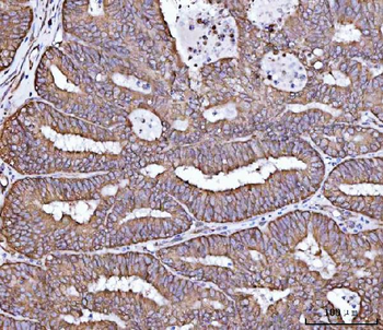 RPL36 Rabbit Polyclonal Antibody