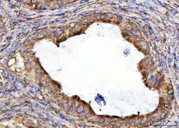 RPL36 Rabbit Polyclonal Antibody