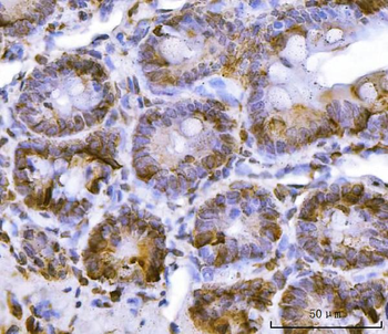 RPL36 Rabbit Polyclonal Antibody