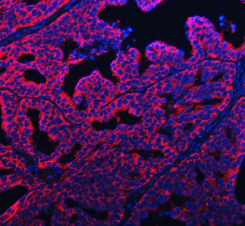 APP-1/PABPC4/APP Rabbit Polyclonal Antibody