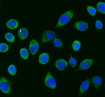 APP-1/PABPC4/APP Rabbit Polyclonal Antibody