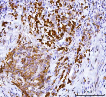 APP-1/PABPC4/APP Rabbit Polyclonal Antibody