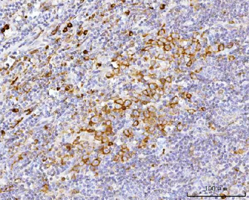 APP-1/PABPC4/APP Rabbit Polyclonal Antibody