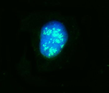 NOP58 Rabbit Polyclonal Antibody