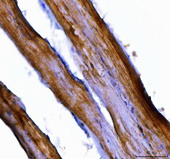 Nedd4 Rabbit Polyclonal Antibody