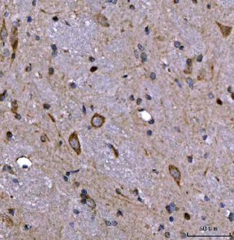 Nedd4 Rabbit Polyclonal Antibody
