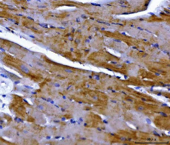 NDUFS2 Rabbit Polyclonal Antibody