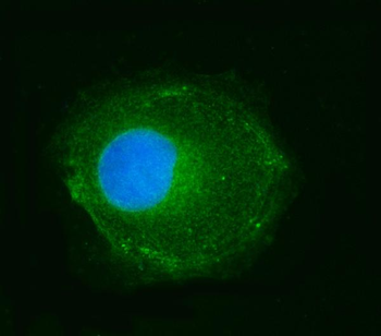 NDUFS2 Rabbit Polyclonal Antibody