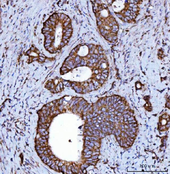 NDUFS2 Rabbit Polyclonal Antibody