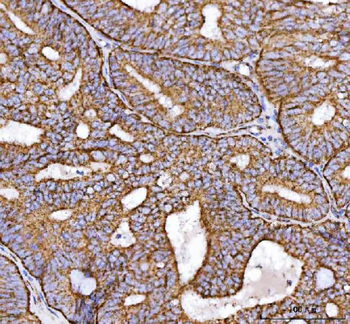NDUFS2 Rabbit Polyclonal Antibody