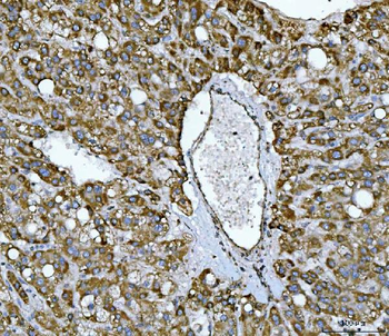 NDUFS2 Rabbit Polyclonal Antibody