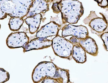 MRPS18B Rabbit Polyclonal Antibody