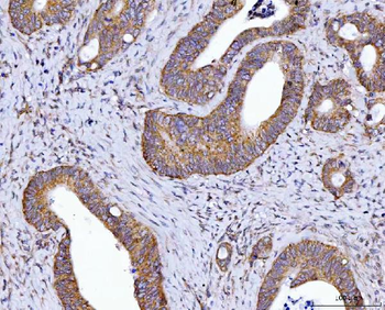 HAX1 Rabbit Polyclonal Antibody