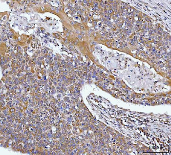 HAX1 Rabbit Polyclonal Antibody
