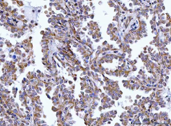 HAX1 Rabbit Polyclonal Antibody