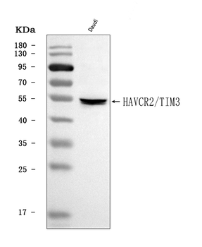 TIM 3/HAVCR2 Rabbit Polyclonal Antibody