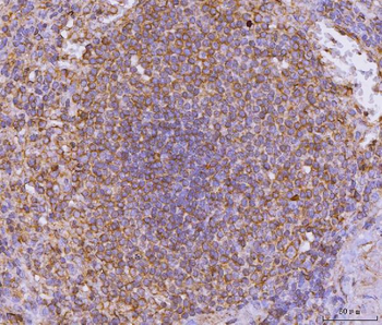 CD135/FLT3 Rabbit Polyclonal Antibody