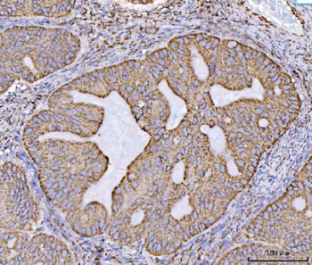 ECHS1 Rabbit Polyclonal Antibody