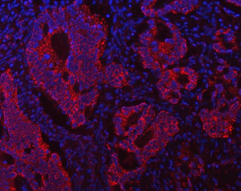 ECHS1 Rabbit Polyclonal Antibody