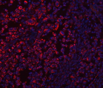 ECHS1 Rabbit Polyclonal Antibody