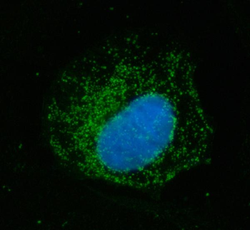 ECHS1 Rabbit Polyclonal Antibody