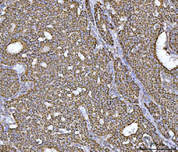 ECHS1 Rabbit Polyclonal Antibody