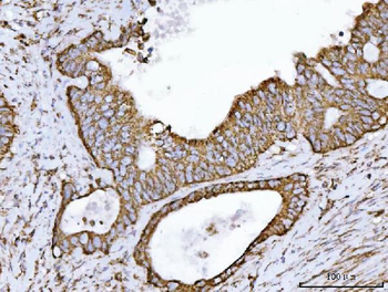 ECHS1 Rabbit Polyclonal Antibody