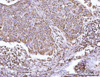 ECHS1 Rabbit Polyclonal Antibody