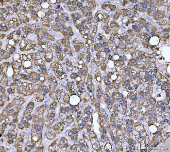ECHS1 Rabbit Polyclonal Antibody