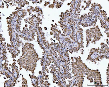 ECHS1 Rabbit Polyclonal Antibody
