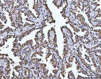 COX5B Rabbit Polyclonal Antibody