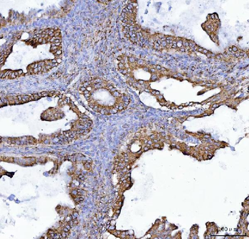 COX5B Rabbit Polyclonal Antibody