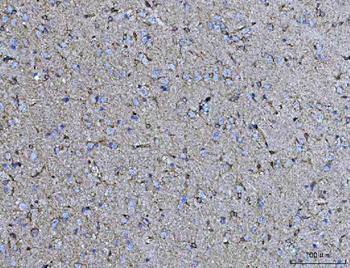 COX5B Rabbit Polyclonal Antibody