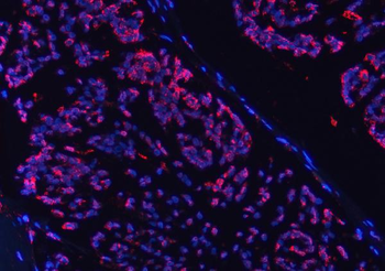 COX5B Rabbit Polyclonal Antibody