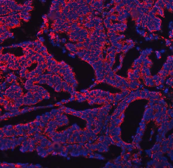 COX5B Rabbit Polyclonal Antibody