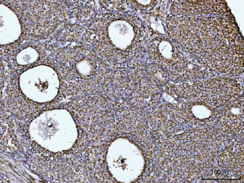 COX5B Rabbit Polyclonal Antibody