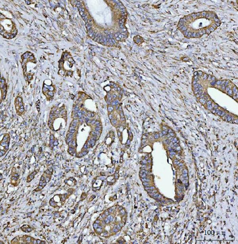 COX5B Rabbit Polyclonal Antibody